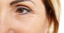 Aging & Fine Lines